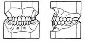 Masticazione Fattori occlusali Occlusione centrica: 1) I denti superiori si collocano all'esterno degli inferiori, nei molari e premolari di circa mezzo dente.