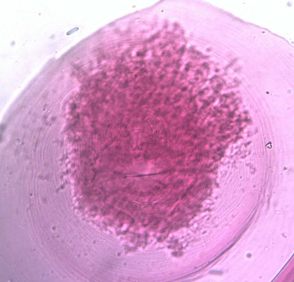 Il genere Meloidogyne comprende un centinaio di specie, morfologicamente molto simili tra loro.