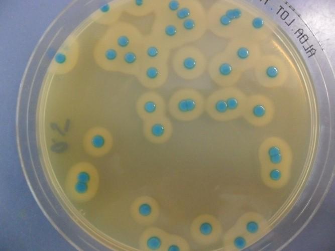 Piano integrativo di controllo per la ricerca di Listeria monocytogenes nelle imprese alimentari 10 È stato predisposto per: Verificare la presenza di