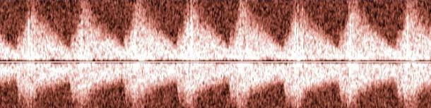 Sonda settoriale (2 3 Hz)