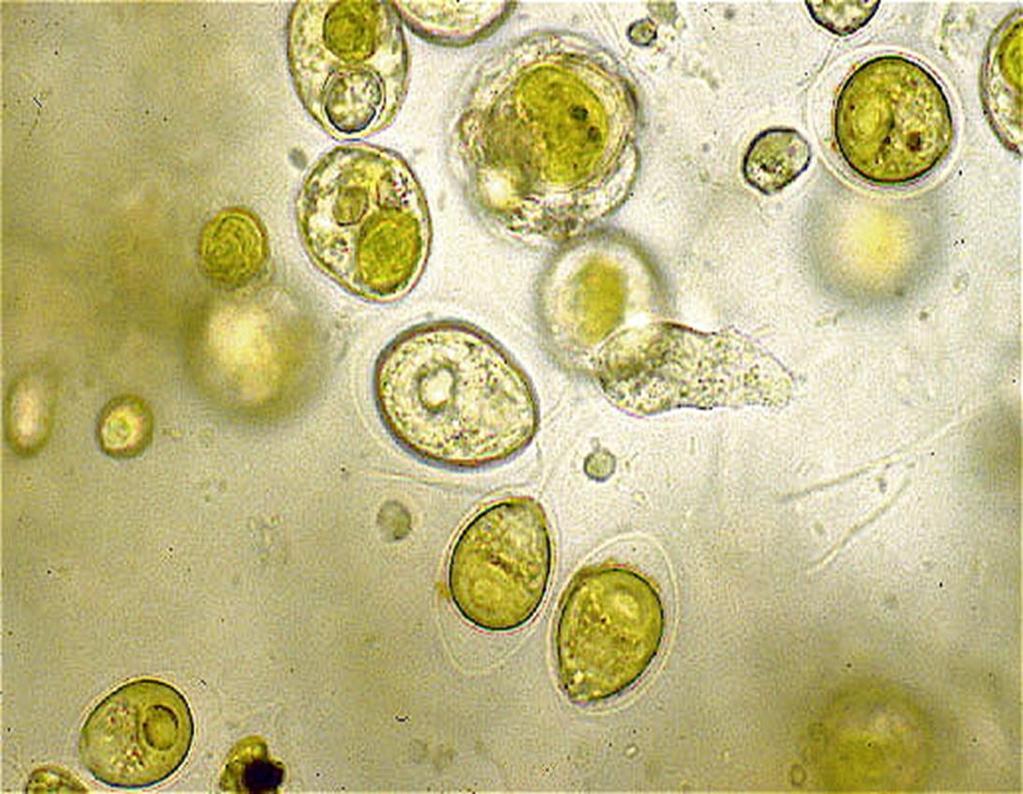 Classificazione delle alghe Alghe verdi: utilizzano la clorofilla vivono soprattutto negli ambienti