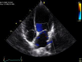 V. ambulatoriale C. cardiologico C. cardiologico Ecocardiografia Ecocardiografia C. cardiologico C. cardiologico Ecocardiografia C.