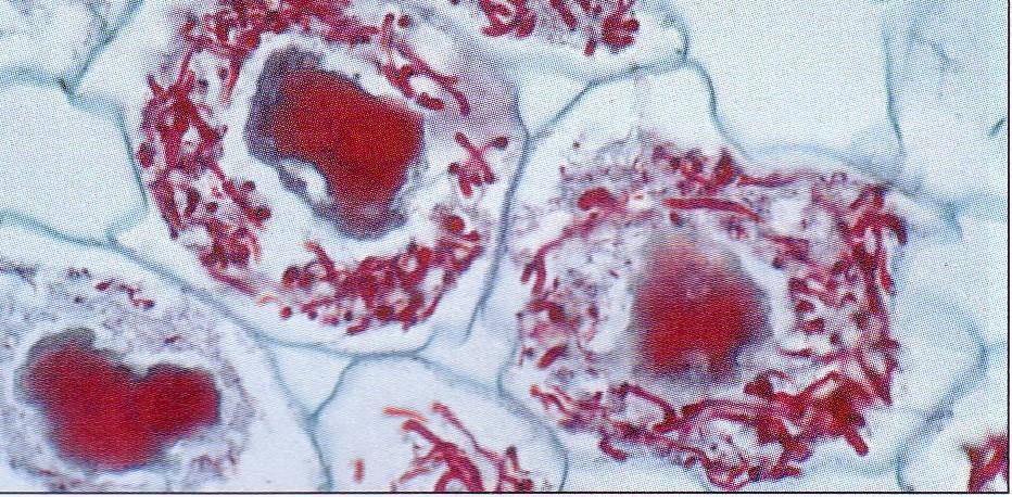 fungine penetrano all interno delle cellule