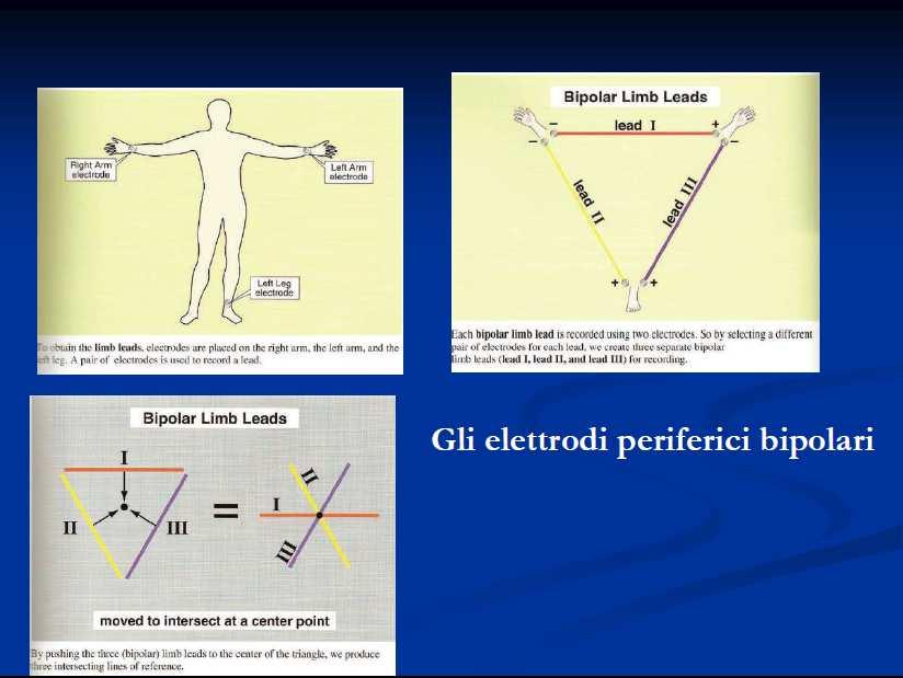 Gli elettrodi periferici bipolari 3 elerodi braccio destro/braccio sinistro/gamba sinistra ogni derivazione è oenuta da 2 elerodi Ogni deriv bipolare degli ar è