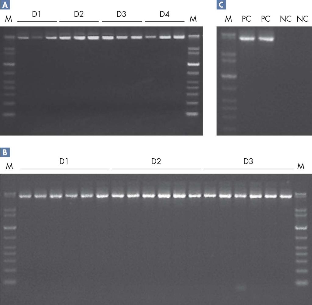 Integrità del DNA I prodotti di PCR a lungo raggio (5 kb) sono stati amplificati con il kit QIAGEN LongRange PCR (reazione di 50 μl). M D1 D2 D3 D4 M M PC PC NC NC M D1 D2 D3 M Figura 4.