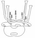 Lo schienale è smontabile in modo che possa essere montato nella parte anteriore per il funzionamento autonomo o nella parte posteriore per l'utilizzo con assistente; E.