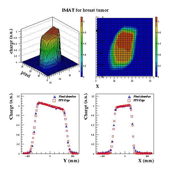 Modulated arc therapy for breast