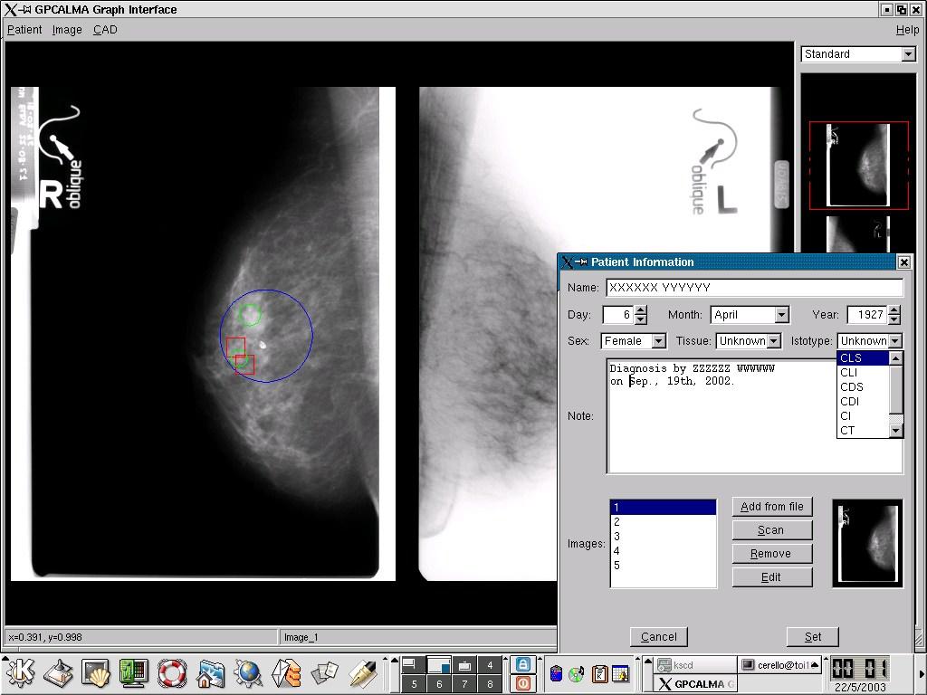 Medical Images w/ CAD (Computer Aided Design) and GRID