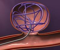 HELICAL COIL: La spirale tende ad appoggiarsi alle pareti dello aneurisma con