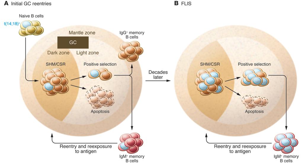 Linfoma Follicolare : BCL-2