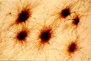 Astrociti Astrocitoma sub-ependimale Anticorpi anti-gfpa astocita protoplasmatico astocita fibroso Sono le cellule di