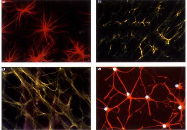 GFAP filamenti intermedi: astrociti, vimentina microglia e oligodendrociti (anche