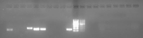 L ordine seguito TIPO DI BANDE GENE nell introdurre i mix CELLULA OSSERVATE amplificati nei pozzetti NSC SI è lo stesso seguito nella Nestin ESC NO tabella per i campioni Acqua NO contenenti il DNA