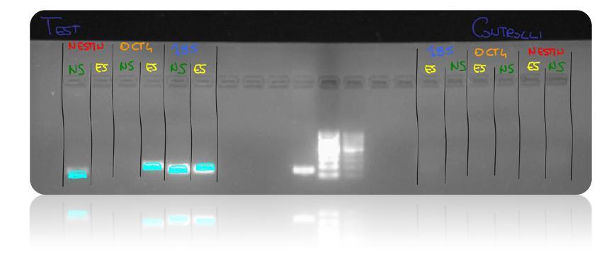 La PCR è riuscita alla perfezione. Si sono amplificati tratti di DNA solo nei composti dove ci aspettavamo preventivamente che il processo avesse effetto.