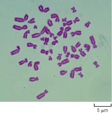 Prometafase Cromosomi completamente condensati Fibre del