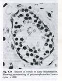 I leucociti si ancorano e rottolano sulle cellule endoteliali attivate e le piastrine.