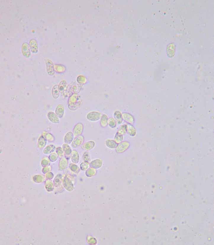 Clitocybe