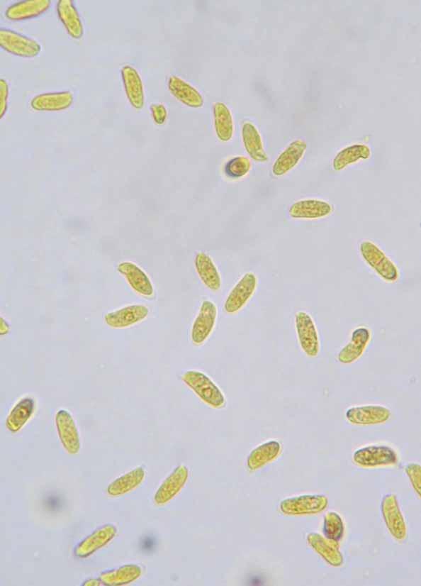 3,5-4 μm Spore