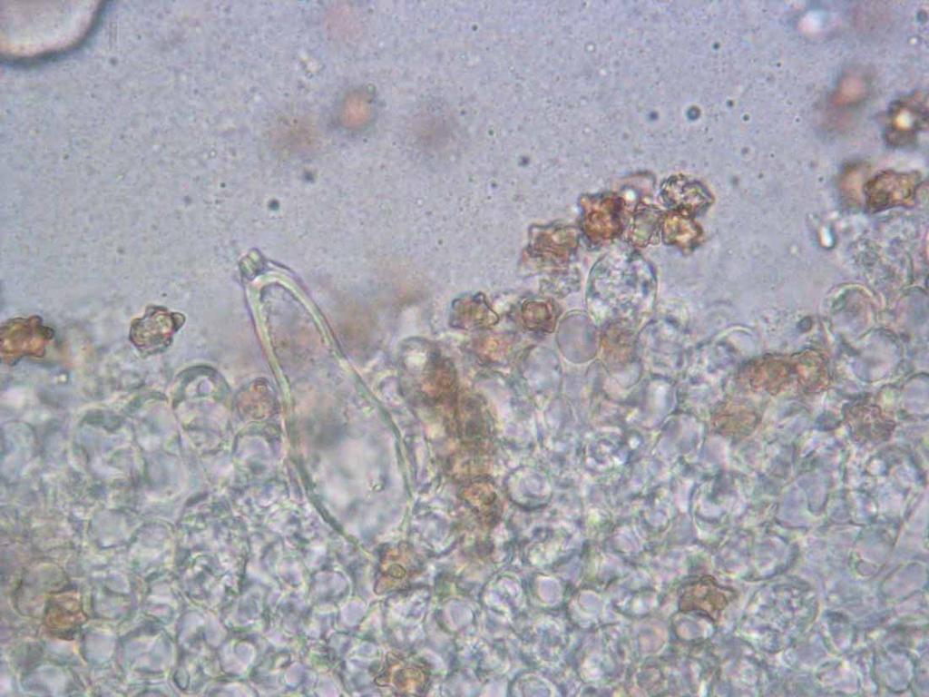Inocybe asterospora Spore