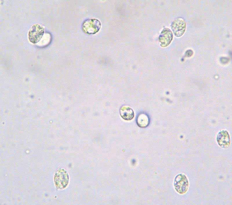 Tricholoma pardinum 8-10x