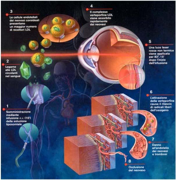 Tecniche terapeutiche basate sul calore