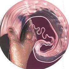 campioni di plasma o di siero di sangue. Potrai determinare se la tua bovina è gravida o vuota.