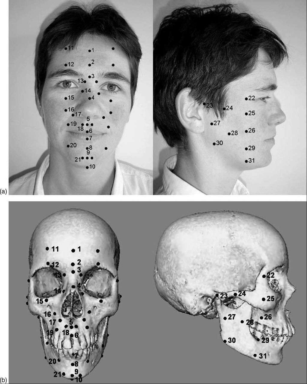 Appendice E. Tabelle e localizzazioni degli spessori di tessuto molle facciale. Figura 8.