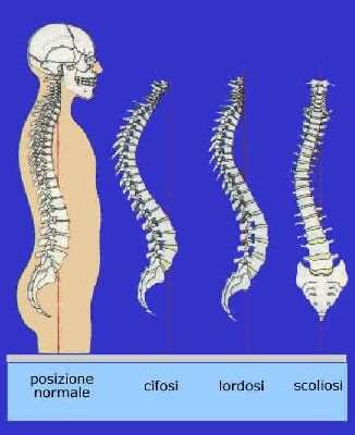 INFORTUNI PER SOVRACCARICO