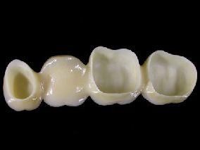 ) CAPSULE DENTALI IN ZIRCONIA SFERE DI ALLUMINA (abrasivo) Curva di trazione di un