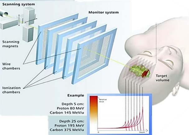 4.1.2 Sistemi di distribuzione attivi A differenza dei sistemi passivi in cui il fascio viene diffuso per coprire l'intera area tumorale, nei sistemi di distribuzione attivi il volume tumorale e'