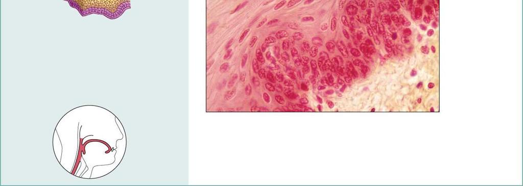 mitosi e producono le cellule Degli strati superficiali Epitelio Pavimentoso stratificato Funzione: Proteggono I tessuti Sottostranti in aree soggette ad abrasione.