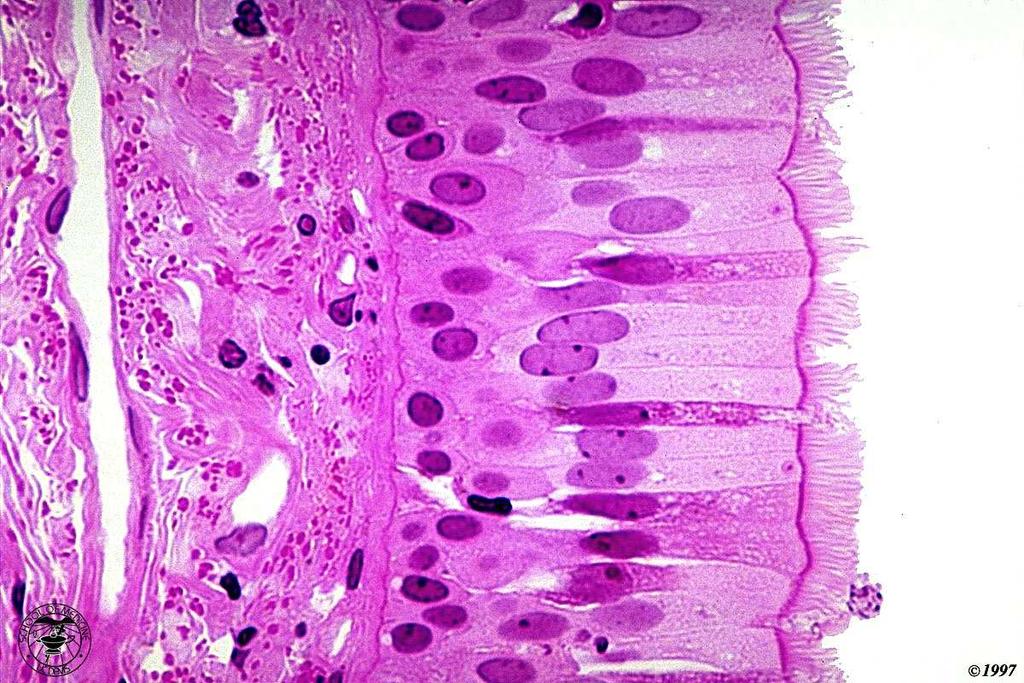 trachea: esempio di epitelio pseudostratificato tutte le cellule sono a contatto con