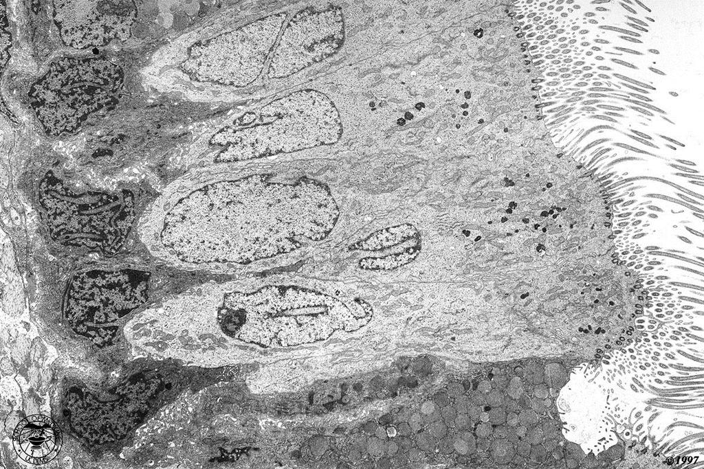 trachea (TEM) cellula basale, che non raggiunge la superficie apicale cellula ciliata; è appena visibile lo scheletro microtubulare