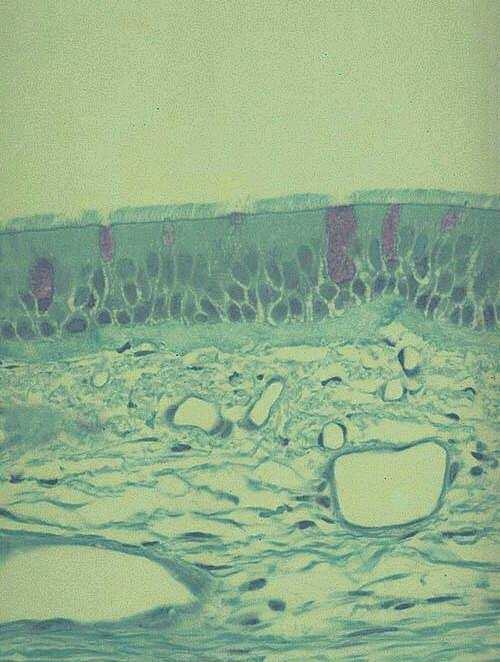 Epitelio cilindrico pluriseriato con