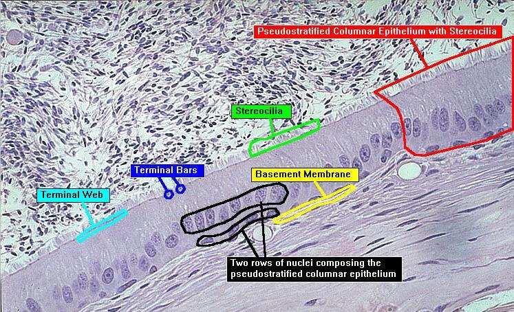 Epitelio cilindrico pluriseriato con