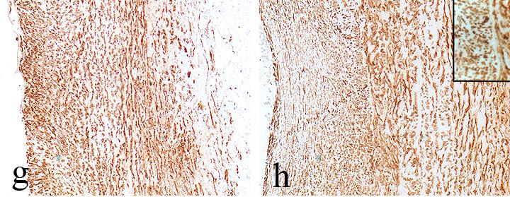 RISULTATO FINALE α-sma CD-68 UP α-sma= α-smooth muscle