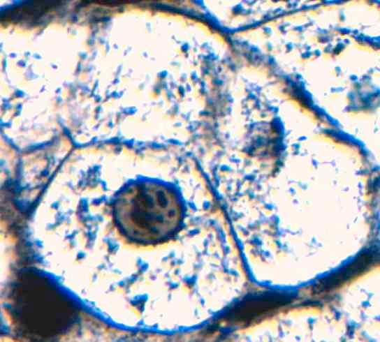 fegato (marcatura istologica) (B) mitocondri disposti nella regione