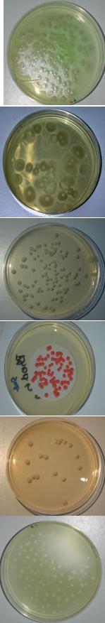 Metodologia e materiali utilizzati - 8 - Pseudomonas aeruginosa Placcatura o filtrazione su Cetrimid-Agar (Merck, Art.