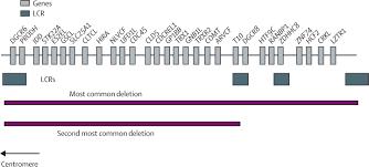 Figura 5 Delezioni più comuni (adattato da riferimento bibliografico n. 32) Il gene maggiormente coinvolto nella delezione è TBX1 (T- box 1).
