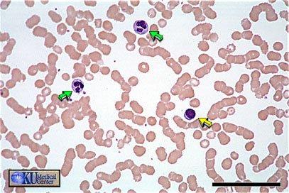 SANGUE Può essere considerato un tipo particolare di tessuto connettivo, nel quale la sostanza fondamentale è liquida