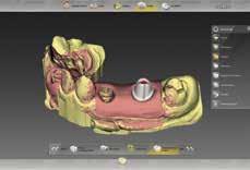 Facendo parte del gruppo Dentsply Sirona, infinident dispone anche di una competenza maturata in più di 30 anni di esperienza nel CAD/CAM dentale.