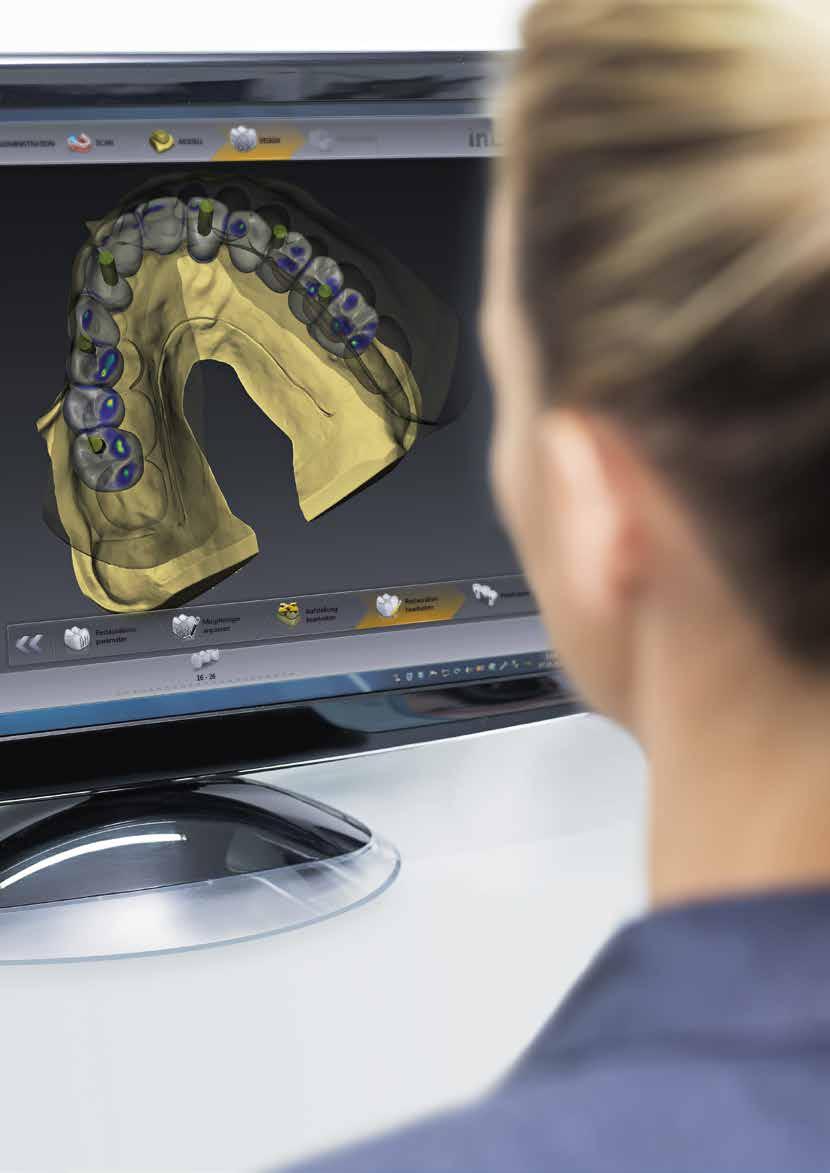 12 I 13 Protesi complesse Modulo Implantologia software CAD inlab Abutment individuali, ponti e barre