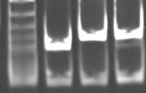 Ripristino parziale dello SPLICING mediante snu1+5a M Wt IVS7+5A +U1+5A RT-PCR 7F-8R Il sequenziamento e la digestione enzimatica confermano la presenza del