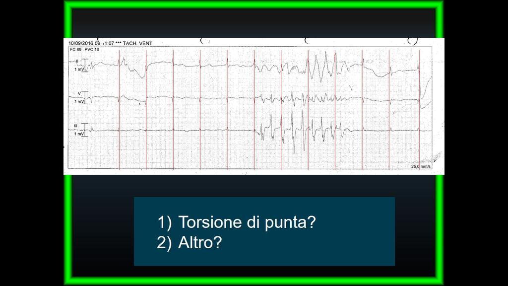 1) 2) Torsione di