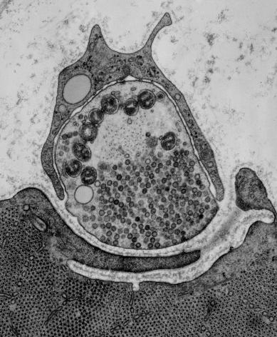 mitocondri assone Vescicole