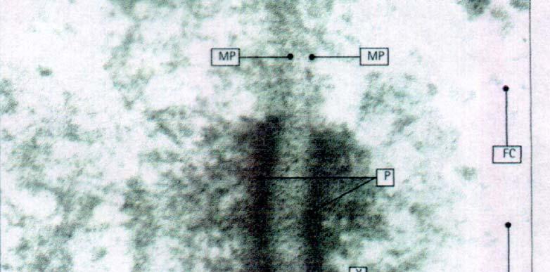 Desmosoma Le placche di adesione discoidali (P) nelle cellule adiacenti si evidenziano come