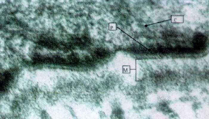 Emidesmosoma Dal punto di vista ultrastrutturale, un emidesmosoma consiste di una placca densa (P),