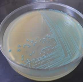 Listeria monocytogenes isolata