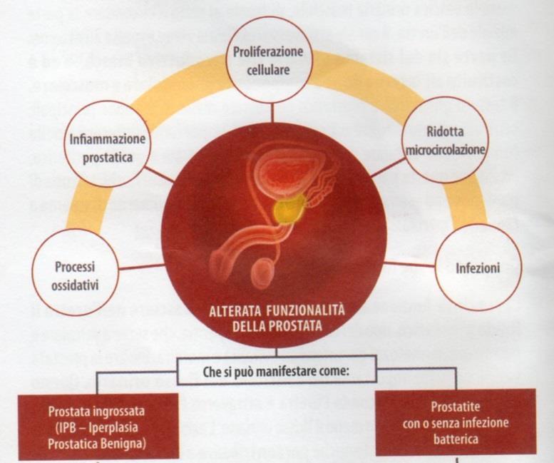 Le alterazioni funzionali e strutturali della prostata "legate all'età" Le dimensioni della prostata cambiano progressivamente con l'età (invecchiando la prostata tende ad ingrossarsi) e in base alle