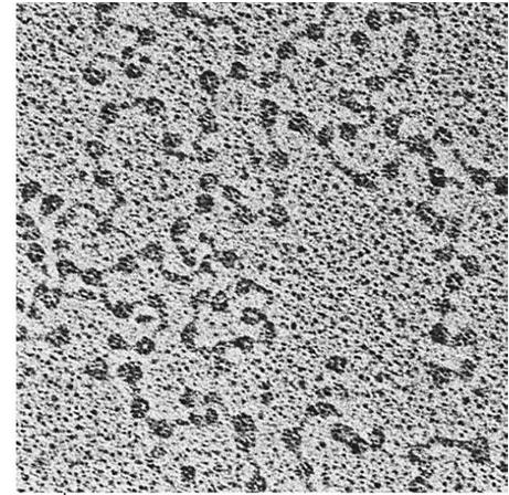 Struttura dei cromosomi eucariotici Nucleosomi - la cromatina contiene ~ un ugual numero di H2A, H2B, H3, H4 ma solo la metà di H1 - struttura a collana con particelle (nucleosomi) di ~100 Å di